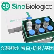 重組人TNFR-2 / CD120b蛋白(ECD, His 標(biāo)簽)