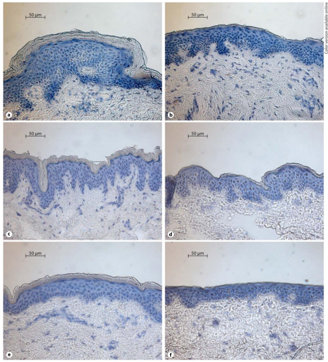 image.png 红外光密度法:体外胶带剥离实验的角质深度标尺
